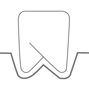 Icon Parodontalbehandlung
